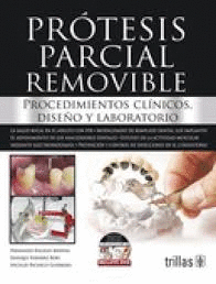 PRÓTESIS PARCIAL REMOVIBLE + DVD