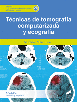 TECNICAS DE TOMOGRAFIA COMPUTARIZADA Y ECOGRAFIA