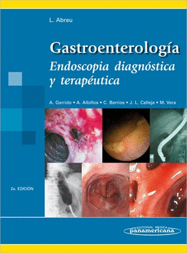 GASTROENTEROLOGIA ENDOSCOPICA DIAGNOSTICA Y TERAPEUTICA