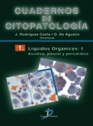 CUADERNOS DE CITOPATOLOGIA 1 LIQUIDOS ORGANICOS I ASCITCO, PLEURAL Y PERICARDICO