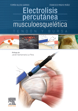 ELECTROLISIS PERCUTANEA MUSCULOESQUELETICA TENDON Y BURSA