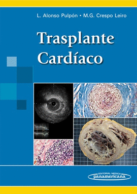 TRASPLANTE CARDIACO
