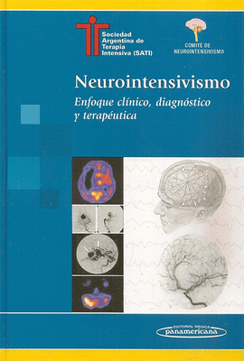 NEUROINTENSIVISMO