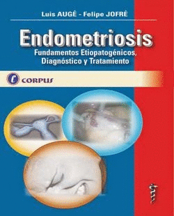 ENDOMETRIOSIS FUNDAMENTOS ETIOPATOGENICOS DIAGNOSTICOS Y TRATAMIENTO