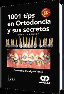 1001 TIPS EN ORTODONCIA Y SUS SECRETOS
