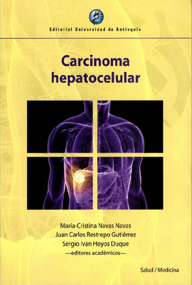 CARCINOMA HEPATOCELULAR