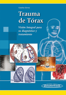 TRAUMA DE TÓRAX