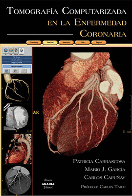 TOMOGRAFIA COMPUTARIZADA EN LA ENFERMEDAD CORONARIA