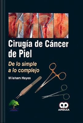 CIRUGIA DE CANCER DE PIEL DE LO SIMPLE A LO COMPLEJO