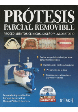 PRTESIS PARCIAL REMOVIBLE