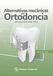 ALTERNATIVAS MEC�NICAS EN ORTODONCIA