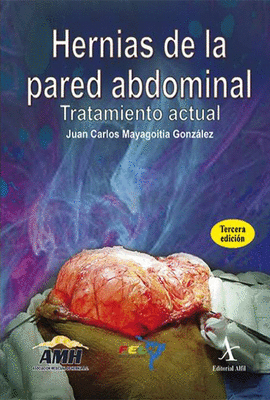 HERNIAS DE LA PARED ABDOMINAL