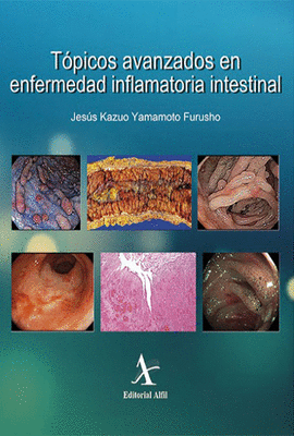 TOPICOS AVANZADOS EN ENFERMEDAD INFLAMATORIA INTESTINAL