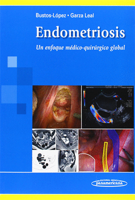 ENDOMETRIOSIS
