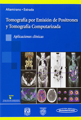 TOMOGRAFIA POR EMISION DE POSITRONES Y TOMOGRAFIA COMPUTARIZADA
