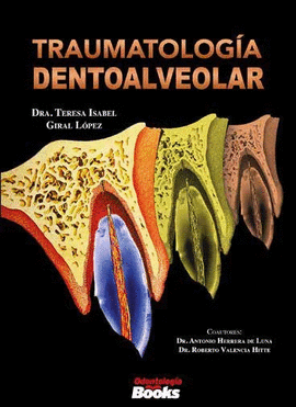 TRAUMATOLOGIA DENTOALVEOLAR