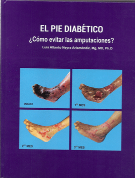 EL PIE DIABTICO