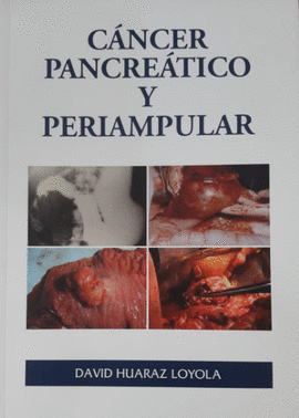 CANCER PANCREATICO Y PERIAMCULAR