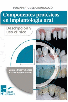 COMPONENTES PROTESICOS EN IMPLANTOLOGIA ORAL