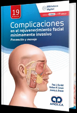 COMPLICACIONES EN EL REJUVENECIMIENTO FACIAL MNIMAMENTE INVASIVO