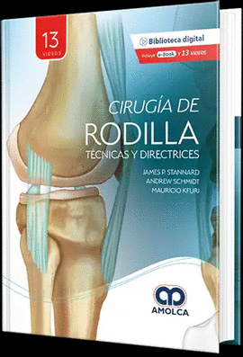 CIRUG�A DE RODILLA