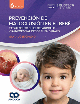 PREVENCI�N DE MALOCLUSI�N EN EL BEB�