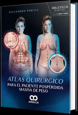 ATLAS QUIRRGICO PARA EL PACIENTE POSPRDIDA MASIVA DE PESO