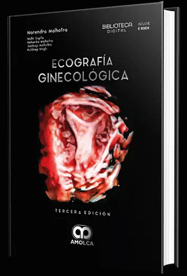 ECOGRAF�A GINECOL�GICA