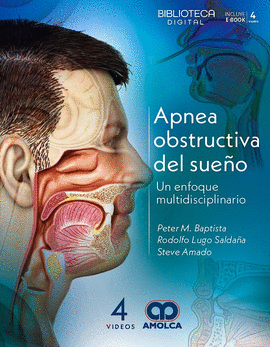APNEA OBSTRUCTIVA DEL SUEO
