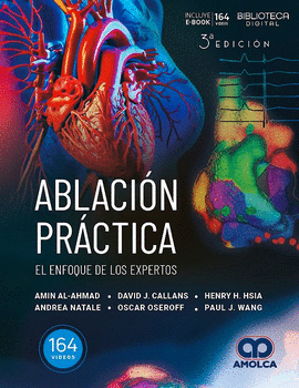 ABLACI�N PR�CTICA