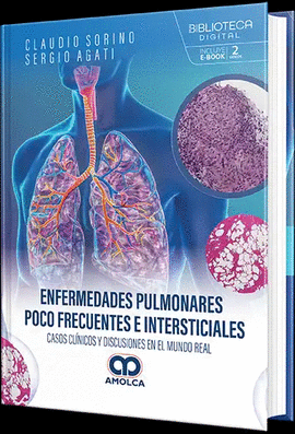 ENFERMEDADES PULMONARES POCO FRECUENTES E INTERSTICIALES