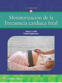 MONITORIZACION DE LA FRECUENCIA CARDIACA FETAL