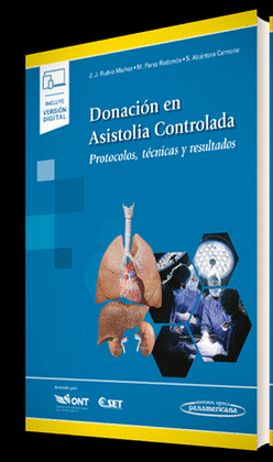 DONACI�N EN ASISTOLIA CONTROLADA