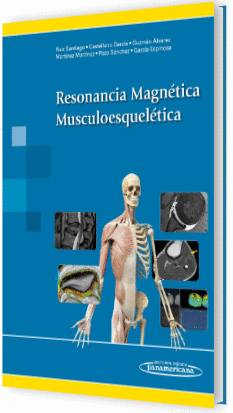 RESONANCIA MAGN�TICA MUSCULOESQUELETICA