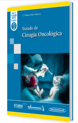 TRATADO DE CIRUG�A ONCOL�GICA