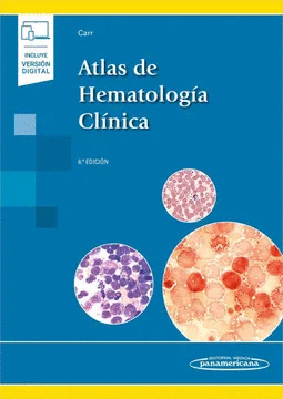 ATLAS DE HEMATOLOGIA CLINICA