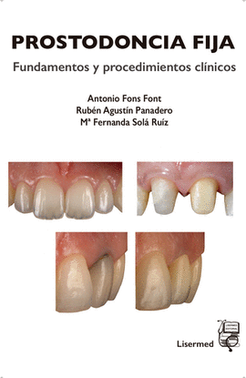 PROSTODONCIA FIJA : FUNDAMENTOS Y PROCEDIMIENTOS CLNICOS