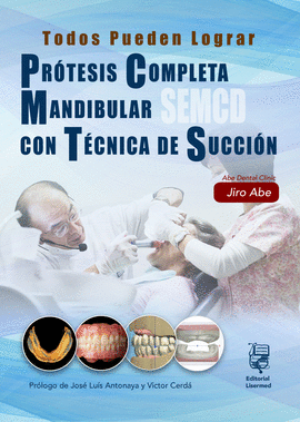PRTESIS COMPLETA MANDIBULAR CON TCNICA DE SUCCIN SEMCD
