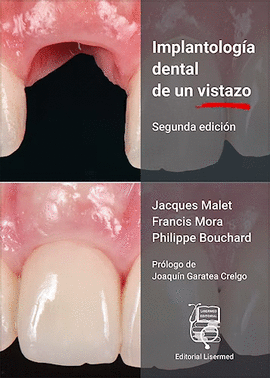 IMPLANTOLOGA DENTAL DE UN VISTAZO