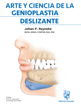 ARTE Y CIENCIA DE LA GENIOPLASTIA DESLIZANTE