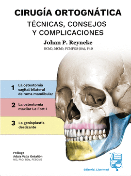 CIRUGIA ORTOGNATICA  TECNICAS, CONSEJOS Y COMPLICACIONES