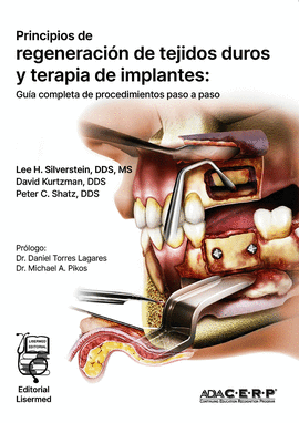 PRINCIPIOS DE REGENERACIN DE TEJIDOS DUROS Y TERAPIA DE IMPLANTES