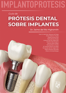 IMPLANTOPRTESIS GUA DE PRTESIS DENTAL SOBRE IMPLANTES