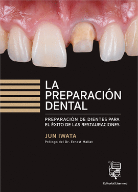 LA PREPARACIN DENTAL