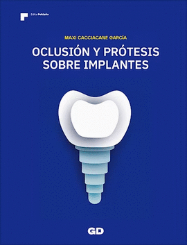OCLUSION Y PROTESIS SOBRE IMPLANTES