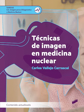 TECNICAS DE IMAGEN EN MEDICINA NUCLEAR