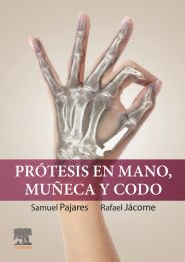 PROTESIS EN MANO MUECA Y CODO