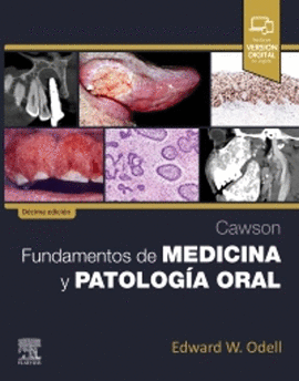 CAWSON FUNDAMENTOS DE MEDICINA Y PATOLOGIA ORAL