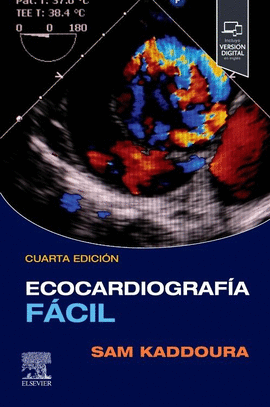 ECOCARDIOGRAFA FCIL