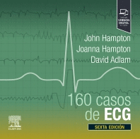 160 CASOS DE ECG
